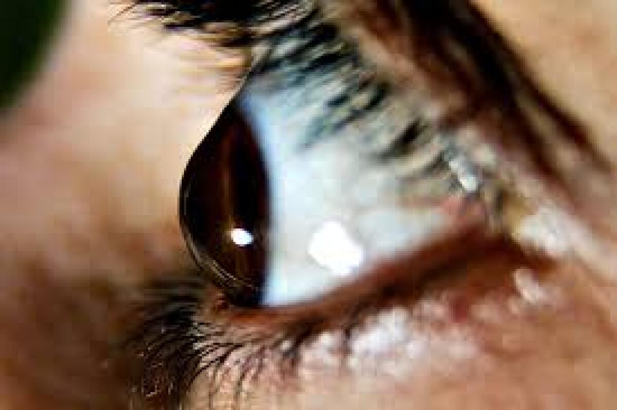 Il cheratocono in Sicilia ha un’incidenza del 3% - 