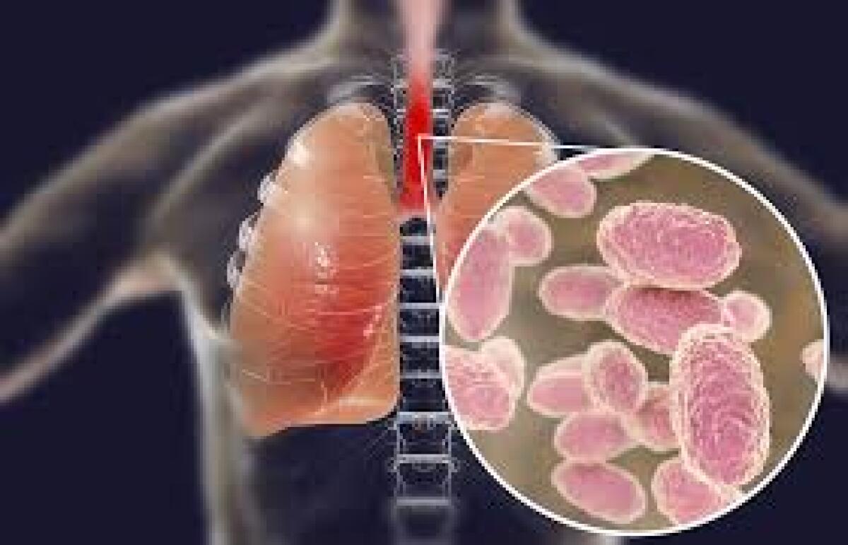 Non più efficace il vaccino della pertosse - 