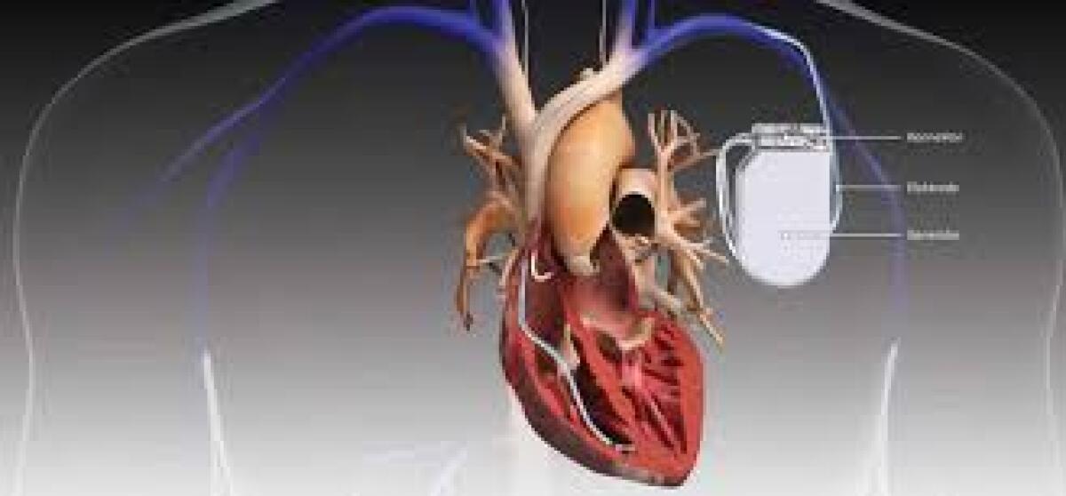Sindrome di Brugada: un importante passo avanti - 