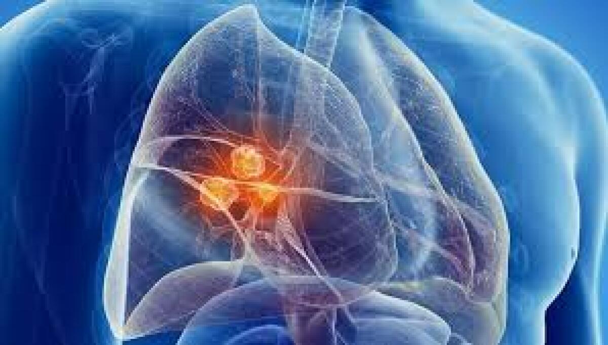 Nuove applicazioni farmacologiche contro cellule di tumori metastatici - 