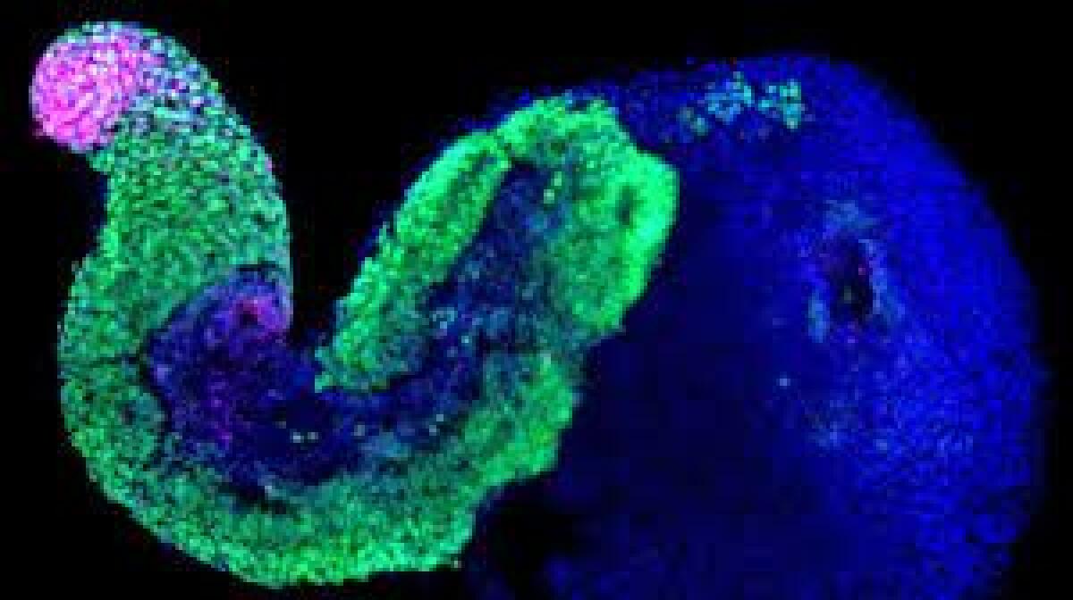 Gastruloidi: una nuova frontiera per la ricerca - 