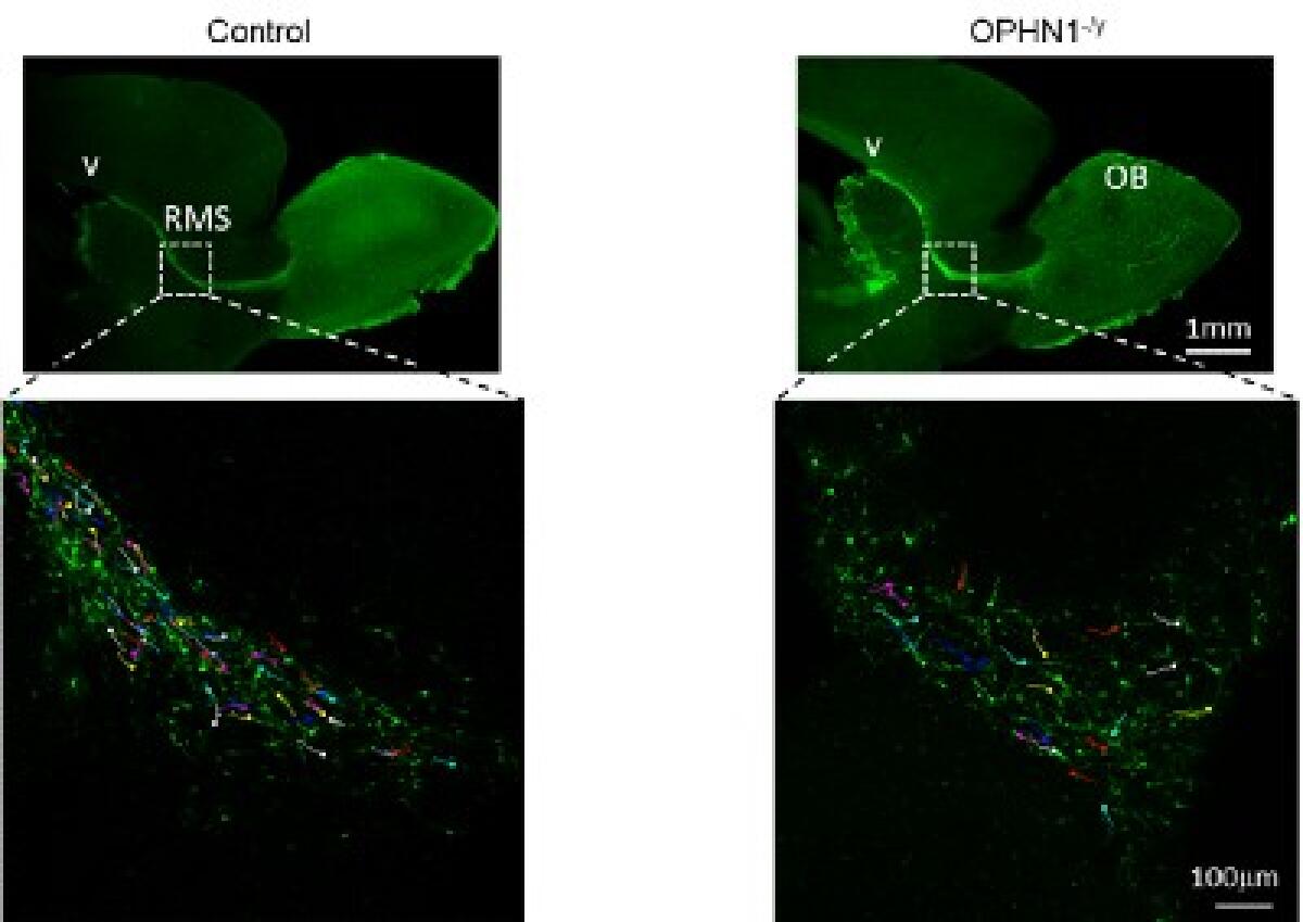 La maturazione precoce dei neuroni alla base delle malattie del neurosviluppo - 