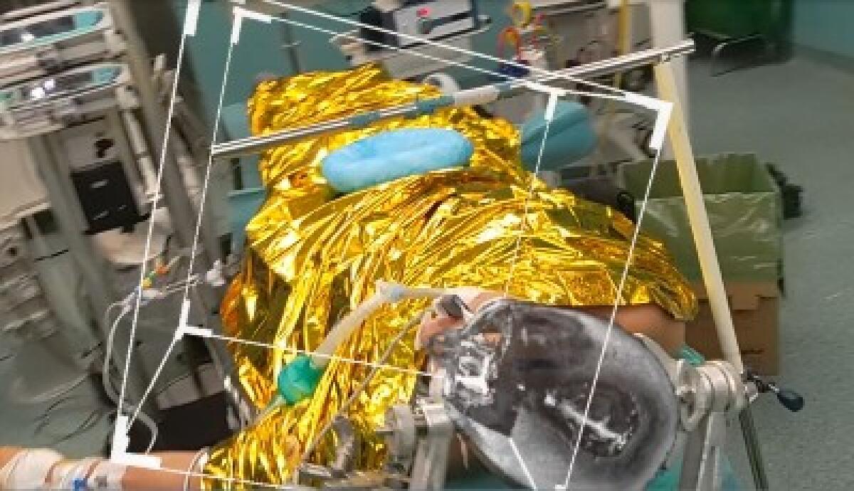 Catania. Ospedale Cannizzaro: realtà aumentata in neurochirurgia - 