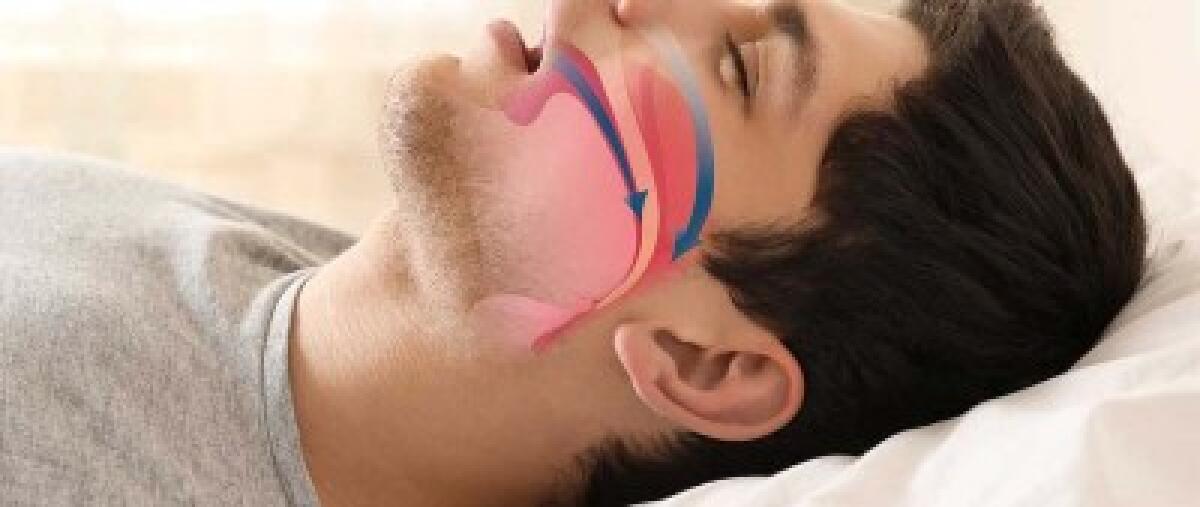 Rivisitazione delle linee guida mondiali per la diagnosi delle apnee notturne - 