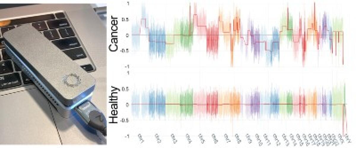 Cancro: predizioni personalizzate con un prelievo di sangue - 