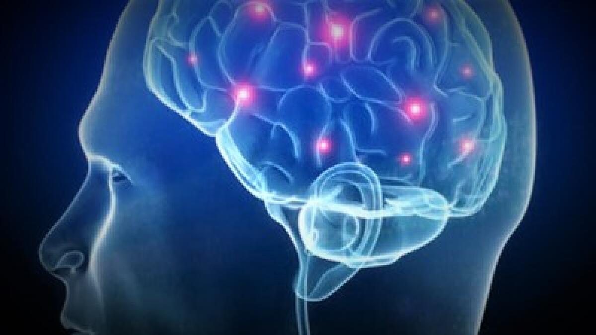 Il Parassita Mangia Cervello - 