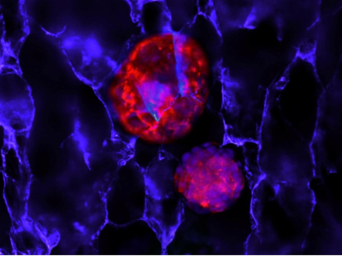 L’idrogel che supporta la crescita di cellule tumorali a lungo termine - 