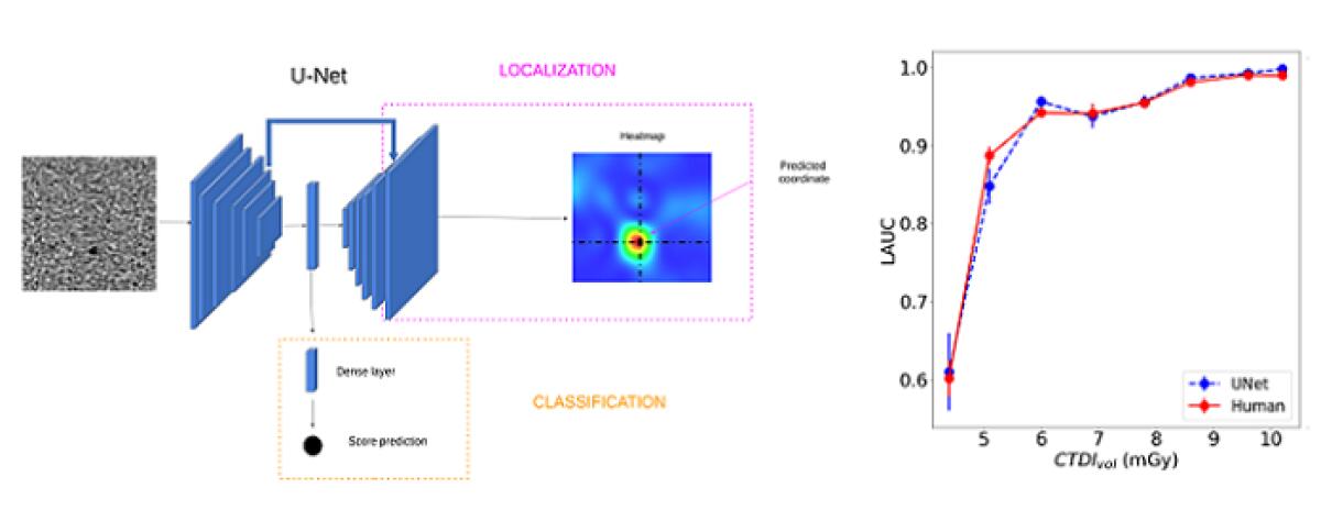 L’intelligenza artificiale per ottimizzare la Tac - 