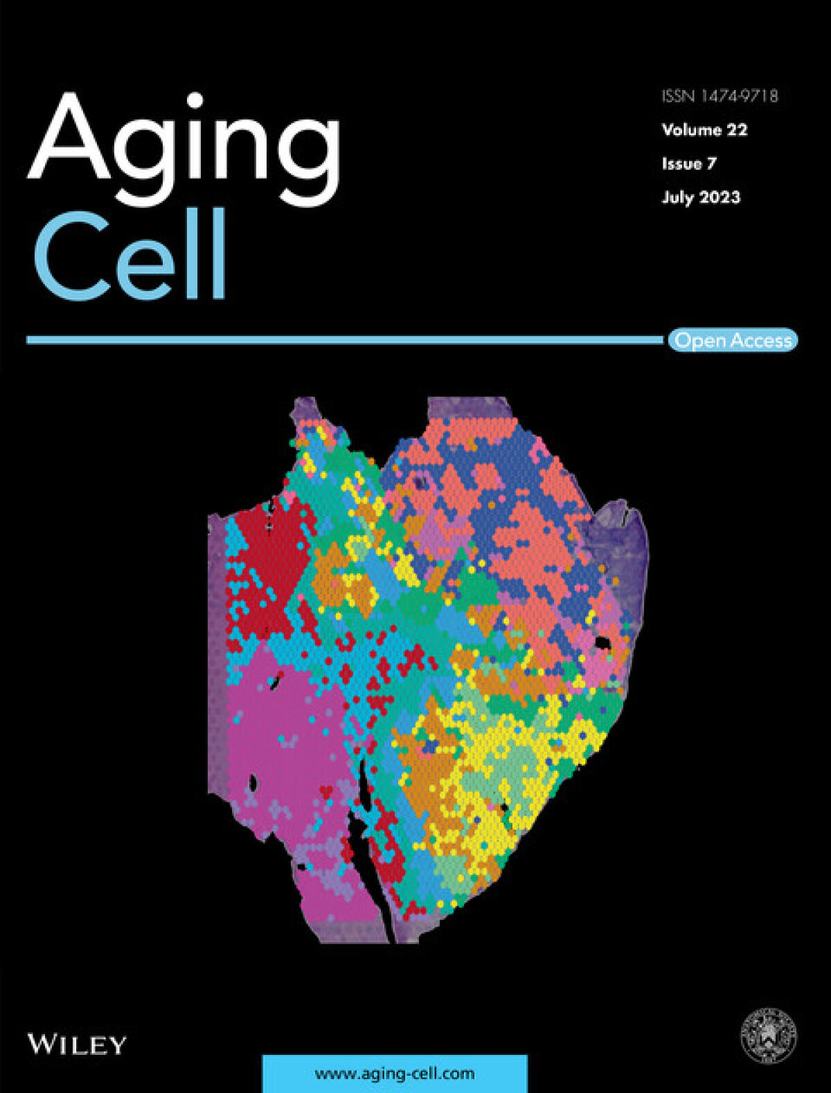 Metastasi del colon retto. Nuovi bersagli terapeutici dalle cellule senescenti - 