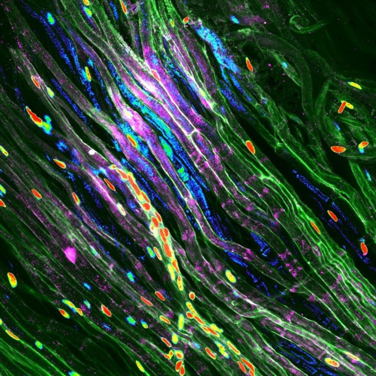 Danno neurologico: la risposta è differente tra maschi e femmine - 