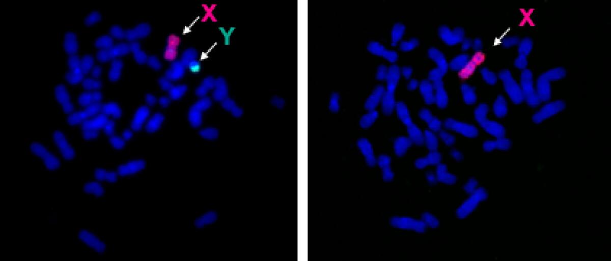 Medicina di genere: nuove informazioni sul “ruolo” del cromosoma Y - 