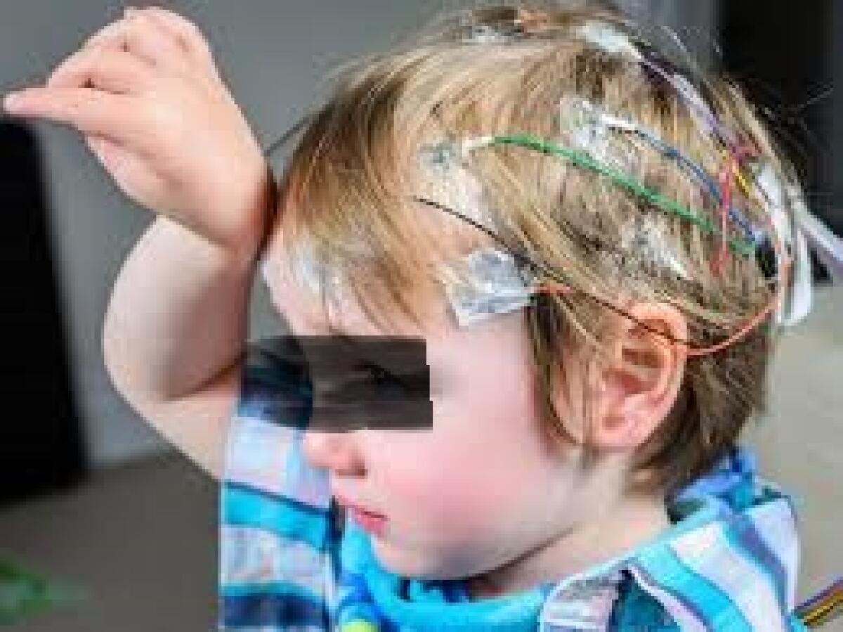 Epilessia pediatrica, una molecola per ridurre i sintomi - 