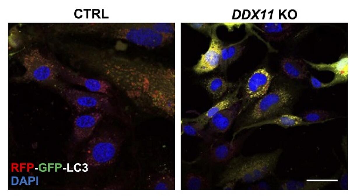Dalla proteina che “pulisce” le cellule nuove speranze per malattie rare e neurodegenerative - 