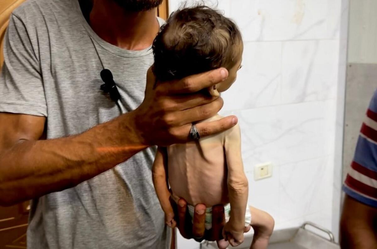 Lettera a Netanyahu, bambini letteralmente “pelle e ossa” - Palestinians mourn their loved ones who lost their lives at Nasser Medical Hospital in Khan Younis, including a child suffering from severe malnutrition, on July 20, 2025.  Photo by Moaz Abu Taha apaimages