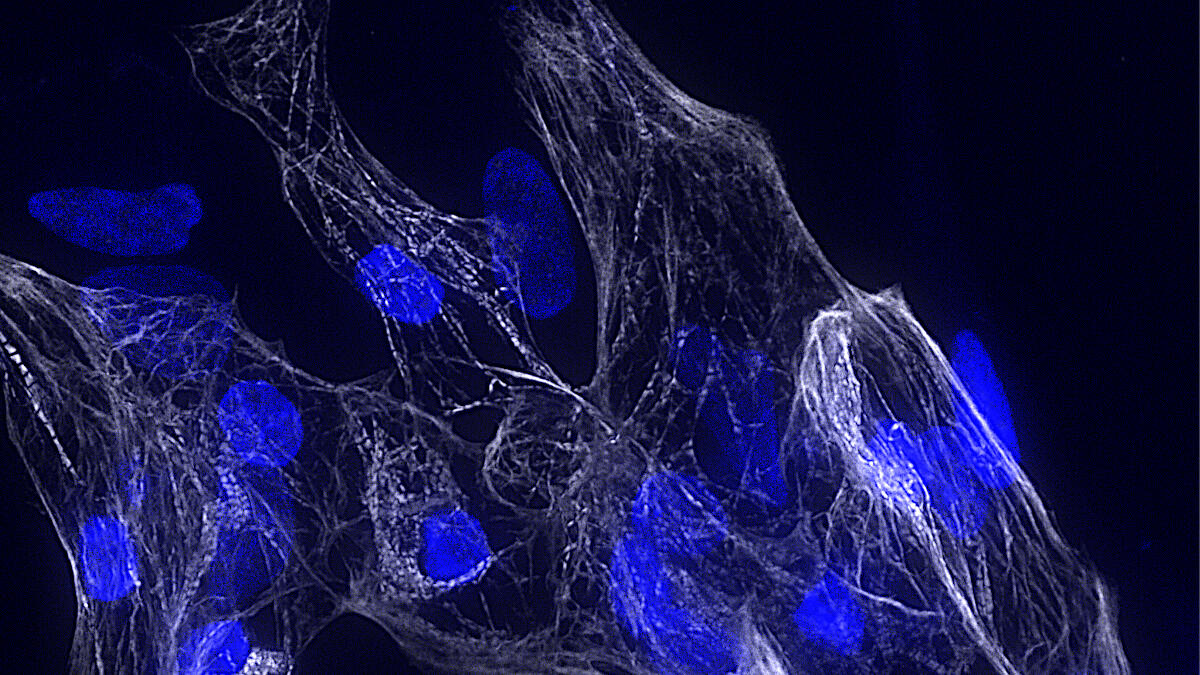 Scoperto un nuovo gene chiave per la salute del cuore - 