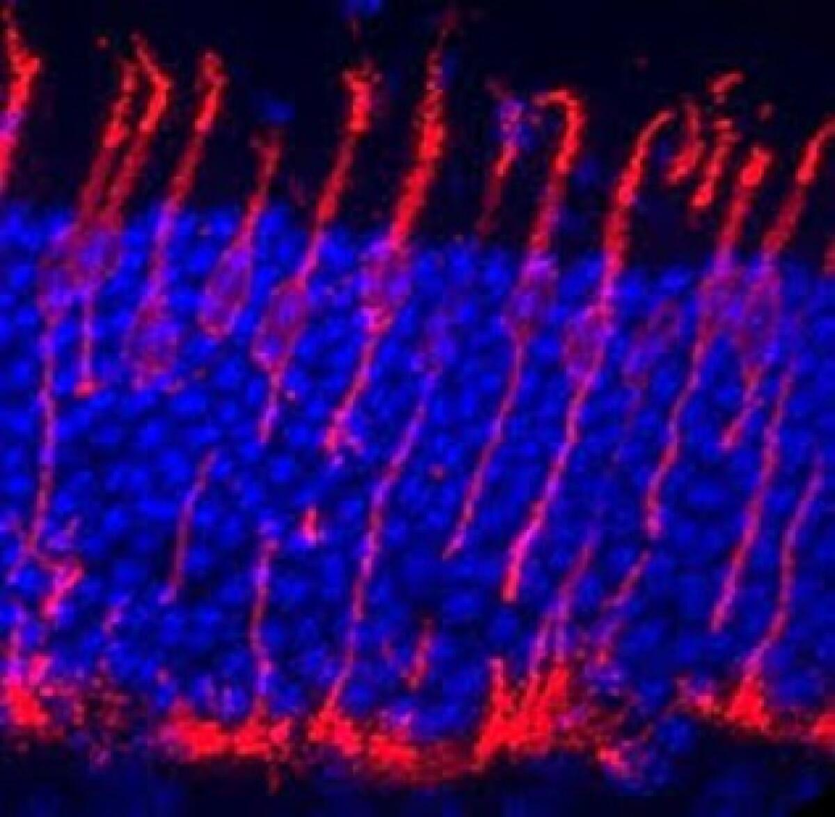 Un farmaco noto apre nuove prospettive per la retinite pigmentosa - 