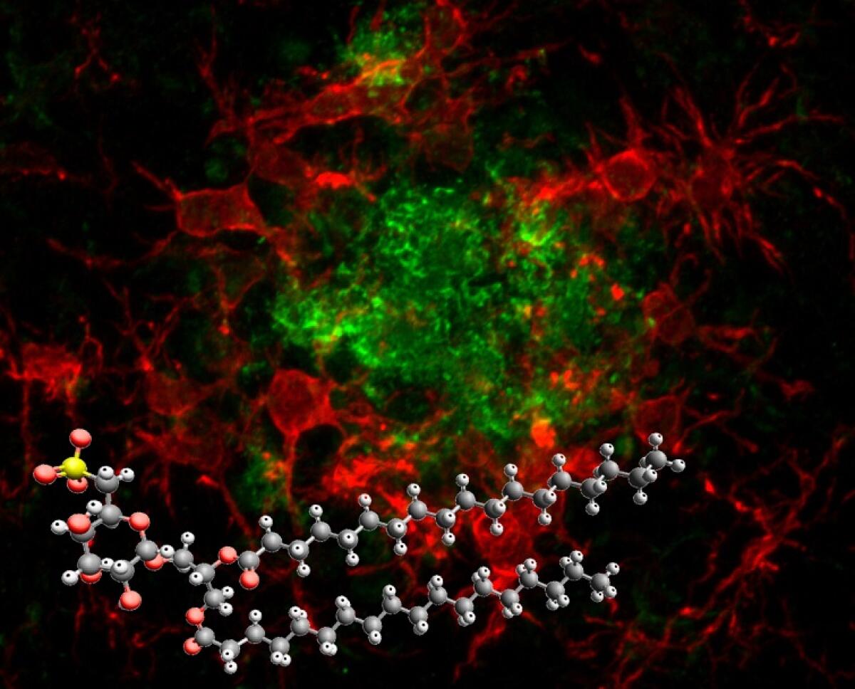 Una “molecola smart” contro l’Alzheimer - 