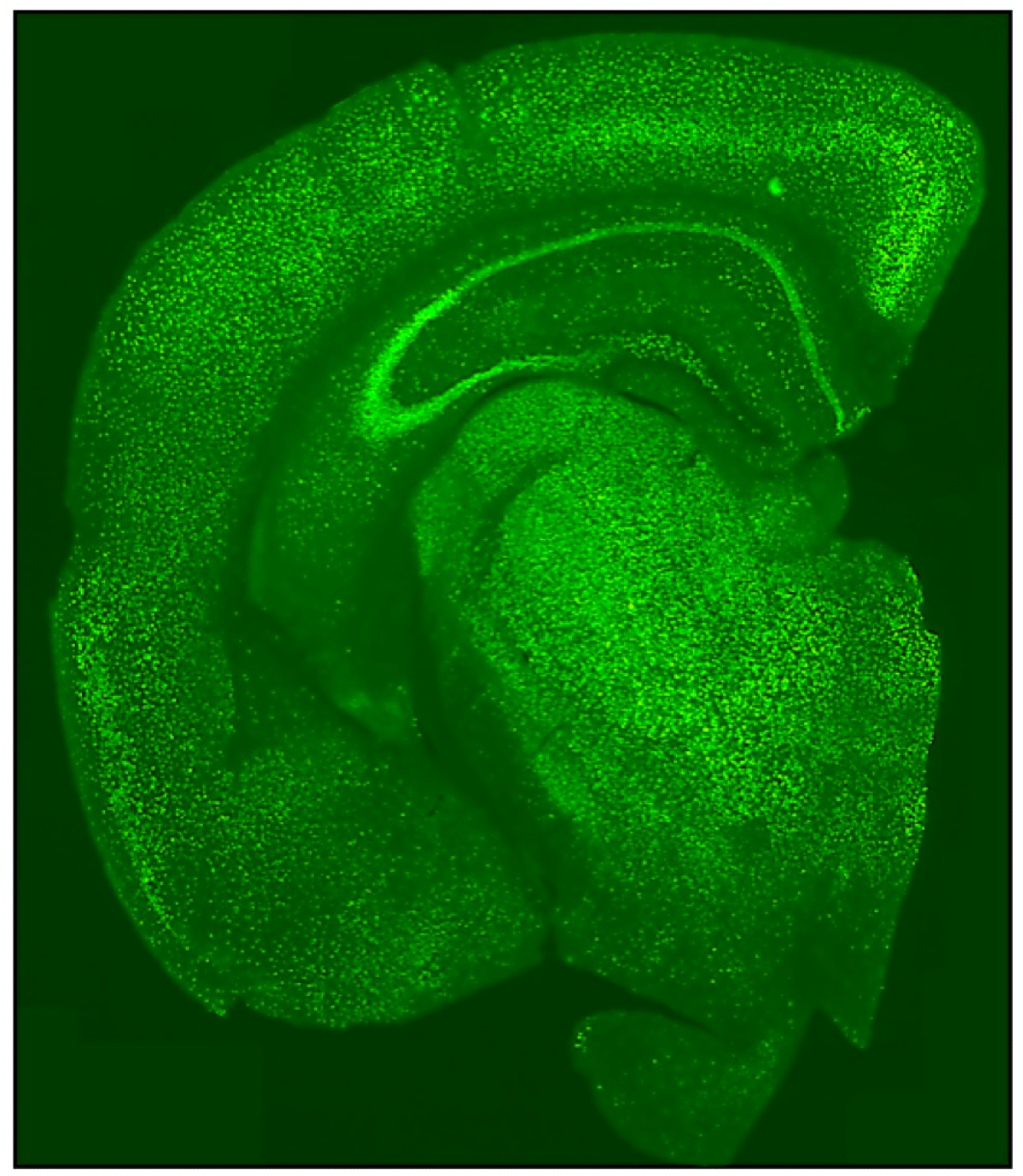 Sindrome di Rett: uno studio italiano indica nuove strade per la terapia genica - 