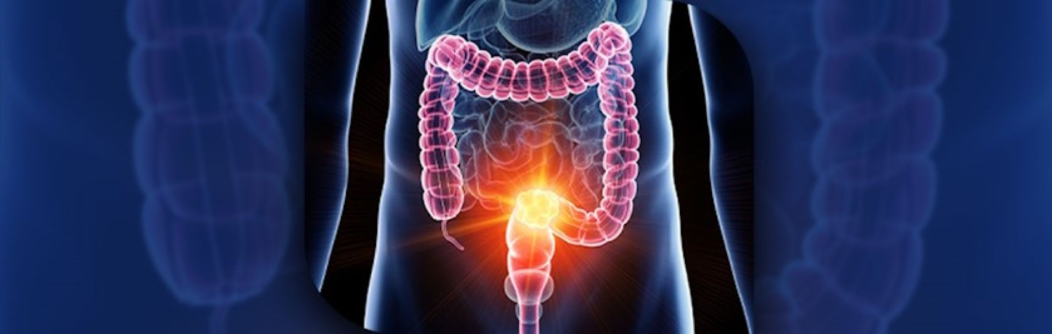 Aspirina e dieta pesco-vegetariana: insieme migliorano la salute intestinale - 