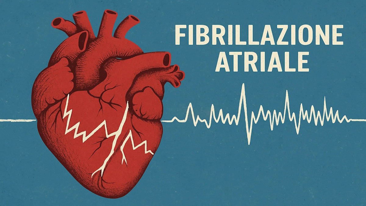 Fibrillazione atriale: rischio cognitivo elevato anche con gli anticoagulanti - 