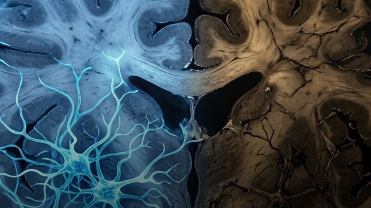 Così le cellule “spengono” i loro interruttori molecolari - 