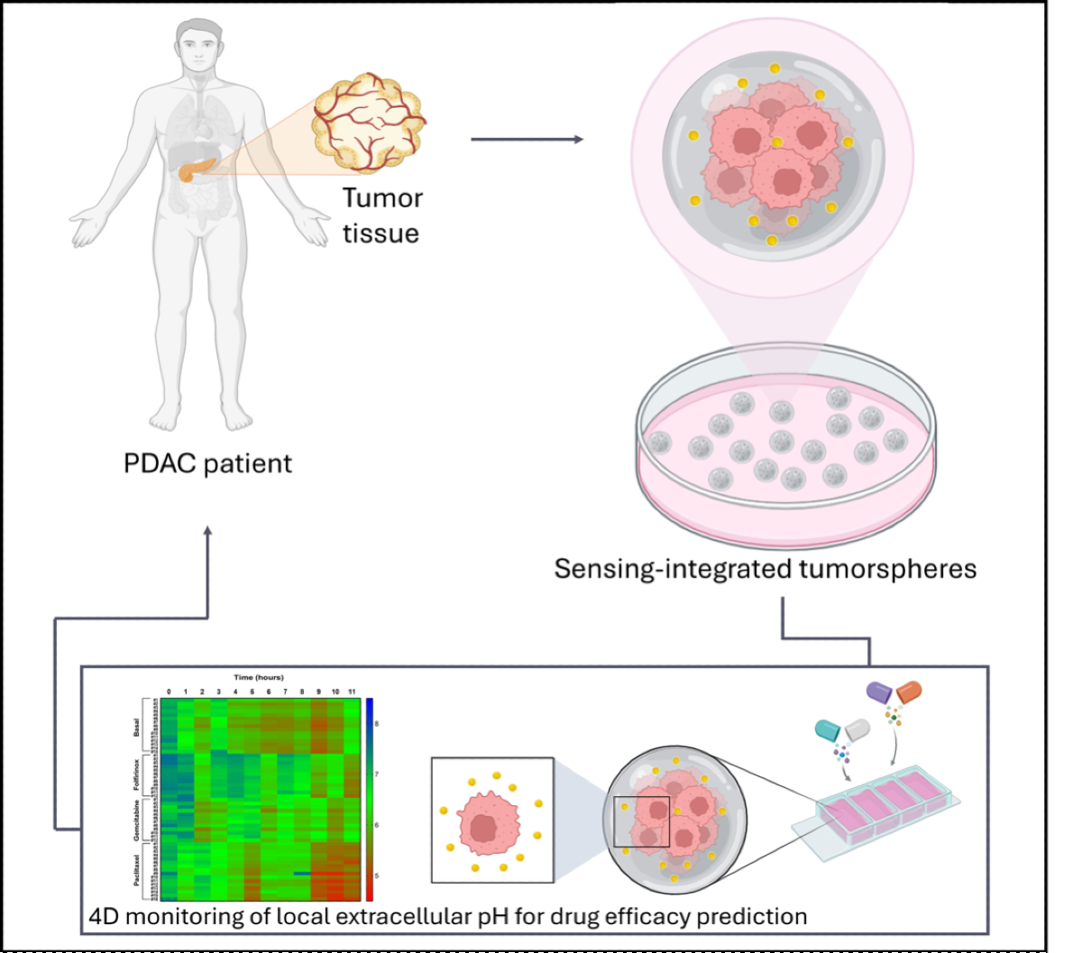 Tumore del pancreas: sensori "intelligenti" nei tessuti misurano la risposta alla chemioterapia - 